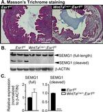 Estrogen Receptor alpha Antibody in Immunohistochemistry (IHC)