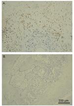 GLUT1 Antibody in Immunohistochemistry (IHC)