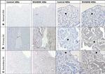 RHAMM Antibody in Immunohistochemistry (IHC)