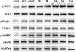 AMPK alpha-1 Antibody in Western Blot (WB)