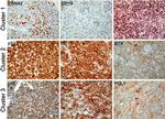 Btk Antibody in Immunohistochemistry (IHC)