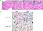 Claudin 1 Antibody in Immunohistochemistry (IHC)