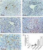 Bcl-2 Antibody in Immunohistochemistry (IHC)