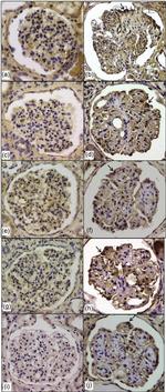 Catalase Antibody in Immunohistochemistry (IHC)