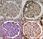 Catalase Antibody in Immunohistochemistry (IHC)