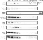 SERCA1 ATPase Antibody in Western Blot (WB)