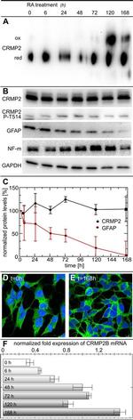 GFAP Antibody in Western Blot (WB)