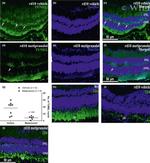Rhodopsin Antibody in Immunohistochemistry (IHC)