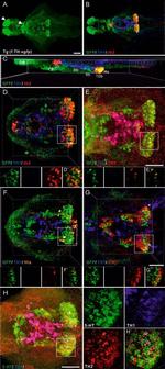 GFP Tag Antibody in Immunohistochemistry (IHC)