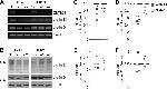 Cyclin E Antibody in Western Blot (WB)