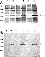 6x-His Tag (C-term) Antibody in Western Blot (WB)