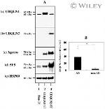 Xpress Antibody in Western Blot (WB)