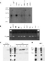 6x-His Tag (C-term) Antibody in Western Blot (WB)