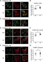 CERT Antibody in Immunocytochemistry (ICC/IF)