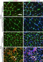 VCAM-1 Antibody in Immunohistochemistry (IHC)