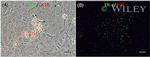 Progesterone Receptor Antibody in Immunocytochemistry (ICC/IF)
