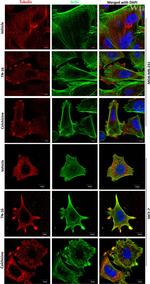 beta Tubulin Antibody in Immunocytochemistry (ICC/IF)