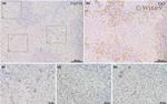 Cytokeratin 7 Antibody in Immunohistochemistry (IHC)