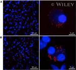 Cannabinoid Receptor 1 Antibody in Immunohistochemistry, Proximity Ligation Assay (PLA) (IHC, PLA)