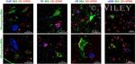 Cannabinoid Receptor 1 Antibody in Immunohistochemistry, Proximity Ligation Assay (PLA) (IHC, PLA)
