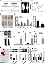 Phospho-ERK1/ERK2 (Thr202, Tyr204) Antibody in Western Blot (WB)