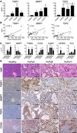 Thrombospondin 2 Antibody in Immunohistochemistry (IHC)