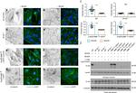 beta-Catenin Antibody in Western Blot, Immunocytochemistry (WB, ICC/IF)