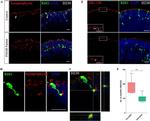 Synaptophysin Antibody in Immunohistochemistry, Immunocytochemistry (IHC, ICC/IF)