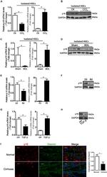 Desmin Antibody in Immunohistochemistry, Immunocytochemistry (IHC, ICC/IF)