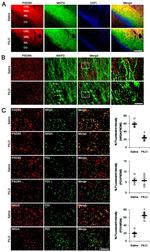 NMDAR2A Antibody in Immunohistochemistry, Immunocytochemistry (IHC, ICC/IF)