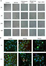Zika Virus NS1 Monoclonal Antibody (E107)