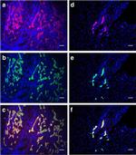 Cytokeratin 19 Antibody in Immunohistochemistry, Immunocytochemistry (IHC, ICC/IF)