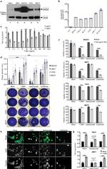 ErbB2 (HER-2) Antibody in Western Blot (WB)