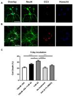 Caspase 3 (Cleaved Asp175) Antibody in Immunocytochemistry (ICC/IF)