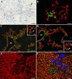 Desmin Antibody in Immunohistochemistry (IHC)