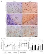 Chromogranin A Antibody in Immunohistochemistry (IHC)