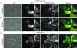ErbB2 (HER-2) Antibody in Immunocytochemistry (ICC/IF)