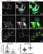 ErbB2 (HER-2) Antibody in Immunocytochemistry (ICC/IF)