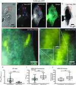 ErbB2 (HER-2) Antibody in Immunocytochemistry (ICC/IF)