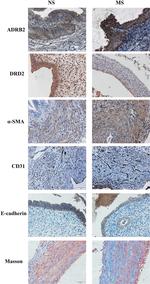 DRD2 Antibody in Immunohistochemistry (IHC)