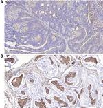 Granzyme B Antibody in Immunohistochemistry (IHC)