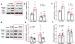 TXNIP Antibody in Western Blot (WB)