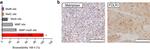 ST14 Antibody in Immunohistochemistry (IHC)