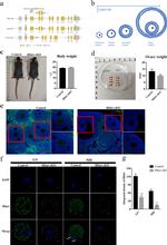 HFM1 Antibody in Immunocytochemistry (ICC/IF)