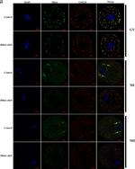 HFM1 Antibody in Immunocytochemistry (ICC/IF)