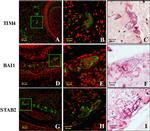 BAI1 Antibody in Immunohistochemistry (IHC)