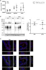 E-cadherin Monoclonal Antibody (ECCD-2)