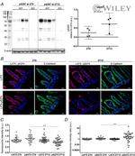 E-cadherin Antibody in Immunohistochemistry (IHC)