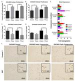 Ki-67 Antibody in Immunohistochemistry (IHC)