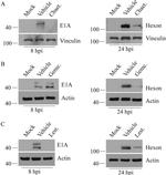 Adenovirus Type 5 Antibody in Western Blot (WB)